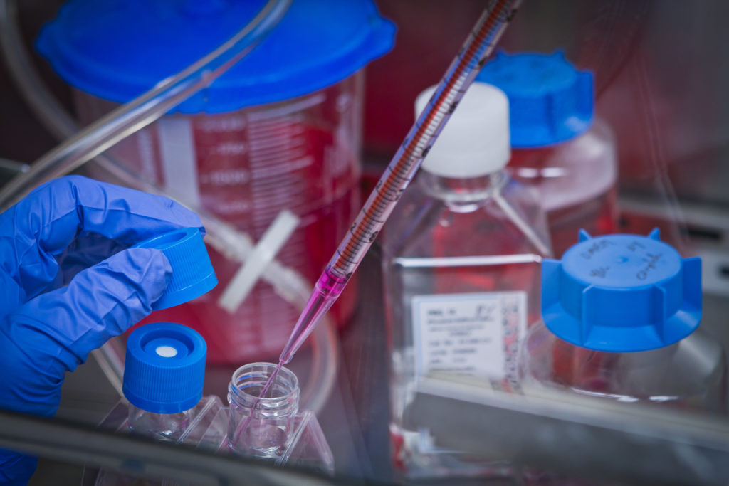 Close up of lab work 23201 scaled